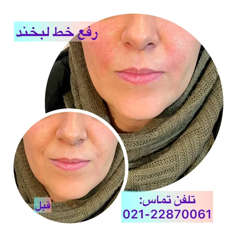 بهترین کلینیک زیبایی در شریعتی تهران